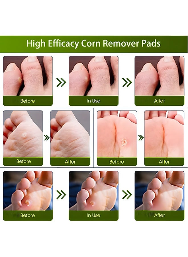 سوميفون لصقات Sumifun لعلاج مسامير القدم (42 لصقة)، تحتوي على مبرد تقشير - لصقات مسامير القدم بمكونات طبيعية مناسبة لمسامير القدم، والجلد المتصلب، والثآليل الأخمصية، والزوائد الجلدية حول الأظافر، وتخفف الألم بسرعة وتحمي صحة القدم. - Image 3